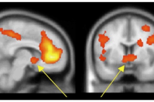 Media_httpsiwsjnetpub_pvaie